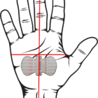 CarpalAID Hand Position Final | Sports Bracing Australia