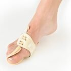 NEOG511 Bunion Correction system 3 | Sports Bracing Australia